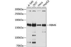 Western blot analysis of extracts of various cell lines, using RBM6 antibody (ABIN6129739, ABIN6146788, ABIN6146789 and ABIN6214632) at 1:2000 dilution. (RBM6 抗体  (AA 530-770))
