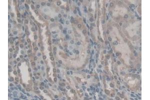IHC-P analysis of Rat Kidney Tissue, with DAB staining. (Retinol Binding Protein 5 抗体  (AA 19-201))