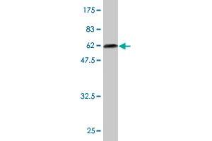 Western Blotting (WB) image for anti-Biliverdin Reductase A (BLVRA) (AA 1-296) antibody (ABIN513741)
