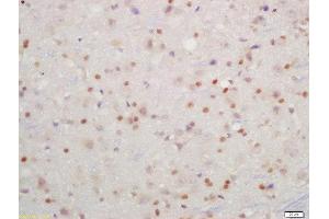 Formalin-fixed and paraffin embedded rat brain labeled with Rabbit Anti-IKK beta(Tyr199) Polyclonal Antibody, Unconjugated  at 1:200 followed by conjugation to the secondary antibody and DAB staining (IKBKB 抗体  (pTyr199))