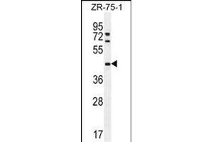 METTL2 Antibody (C-term) (ABIN655892 and ABIN2845293) western blot analysis in ZR-75-1 cell line lysates (35 μg/lane).