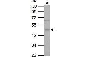 WB Image Sample (30 ug of whole cell lysate) A: PC-3 10% SDS PAGE antibody diluted at 1:1000 (NOVA1 抗体  (C-Term))