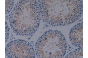 IHC-P analysis of Mouse Testis Tissue, with DAB staining. (CX3CL1 抗体  (AA 83-330))