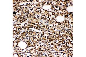 Anti-CD10 Picoband antibody,  IHC(P): Human B lymphocyte Cancer Tissue (MME 抗体  (AA 52-750))