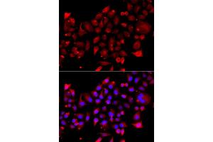 Immunofluorescence analysis of A549 cell using RRM2B antibody. (RRM2B 抗体)