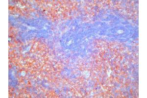 Immunohistochemistry (IHC) image for anti-Complement Component (3b/4b) Receptor 1-Like (CR1L) antibody (ABIN781721) (CR1L 抗体)