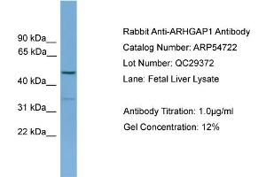WB Suggested Anti-ARHGAP1  Antibody Titration: 0. (ARHGAP1 抗体  (N-Term))