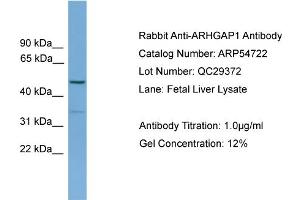 WB Suggested Anti-ARHGAP1  Antibody Titration: 0.