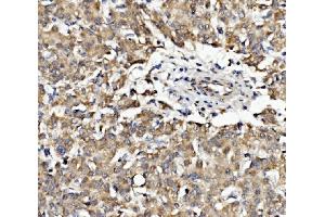 IHC analysis of EPB41L5 using anti-EPB41L5 antibody (ABIN7601550). (EPB41L5 抗体  (AA 38-733))