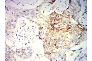 Immunohistochemical analysis of paraffin-embedded brain tissues using GZMB mouse mAb with DAB staining. (GZMB 抗体  (AA 21-247))