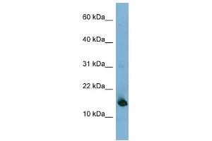 MED31 antibody used at 1 ug/ml to detect target protein. (MED31 抗体  (N-Term))