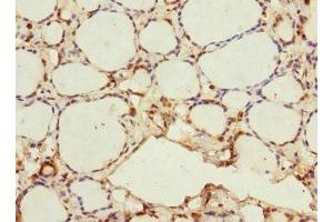 Immunohistochemistry of paraffin-embedded human thyroid tissue using ABIN7165806 at dilution of 1:100 (MEMO1 抗体  (AA 1-297))