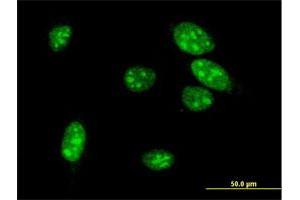 Immunofluorescence of monoclonal antibody to MEOX1 on HeLa cell.