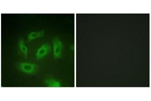 Immunofluorescence analysis of HeLa cells, using TGF beta Receptor I (epitope around residue 165) antibody. (TGFBR1 抗体  (Ser165))