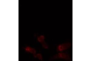 ABIN6276354 staining  Hela cells by IF/ICC. (ABL1 抗体  (N-Term))