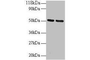 Western blot All lanes: GDI2 antibody at 2 μg/mL Lane 1: 293T whole cell lysate Lane 2: EC109 whole cell lysate Secondary Goat polyclonal to rabbit IgG at 1/15000 dilution Predicted band size: 51, 46 kDa Observed band size: 51 kDa (GDI2 抗体  (AA 1-441))