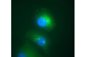 Immunofluorescence staining of Daxx in transfected HeLa human cervix carcinoma cell line. (DAXX 抗体  (AA 558-740))
