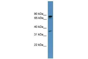 PDE8A antibody used at 0. (PDE8A 抗体  (C-Term))