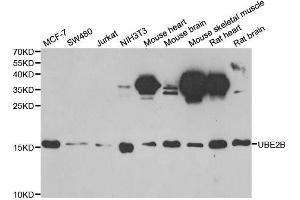 Western blot analysis of extracts of various cell lines, using UBE2B antibody. (UBE2B 抗体  (AA 1-152))