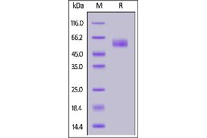 Mouse TREM2, Fc Tag on  under reducing (R) condition. (TREM2 Protein (AA 19-171) (Fc Tag))