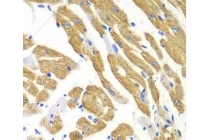 Immunohistochemistry of paraffin-embedded Mouse heart using AIMP1 Polyclonal Antibody at dilution of 1:100 (40x lens). (AIMP1 抗体)