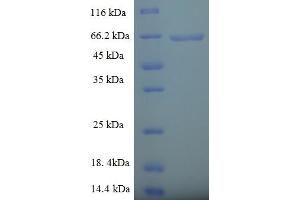 SDS-PAGE (SDS) image for Phospholipase D4 (PLD4) (AA 52-506), (partial) protein (His-SUMO Tag) (ABIN5711579) (Phospholipase D4 Protein (PLD4) (AA 52-506, partial) (His-SUMO Tag))