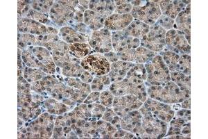 Immunohistochemical staining of paraffin-embedded colon tissue using anti-PIM2 mouse monoclonal antibody.
