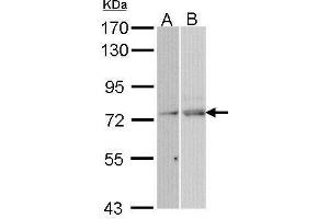 Western blot analysis of 30 ug of whole cell lysate (A: Hela; B: Molt-4) using a 7. (NXF1 抗体)