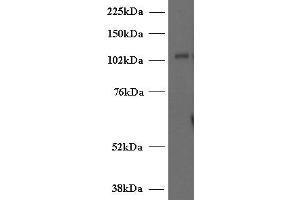 ABIN2563976 (2µg/ml) staining of Human T-lymphocyte lysate (35µg protein in RIPA buffer). (UNC13D 抗体  (Internal Region))