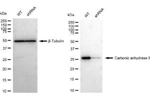 anti-Carbonic Anhydrase II (CA2) antibody