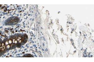 ABIN6267367 at 1/100 staining Mouse intestine tissue by IHC-P. (BCR 抗体  (pTyr360))