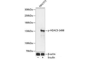 Western blot analysis of extracts of NIH/3T3 cells using Phospho-HDAC5(S498) Polyclonal Antibody at dilution of 1:2000. (HDAC5 抗体  (pSer498))