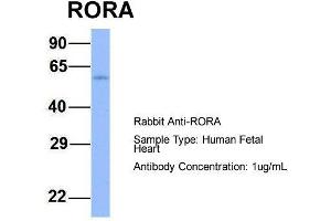 Host:  Rabbit  Target Name:  RORA  Sample Type:  Human Fetal Heart  Antibody Dilution:  1. (RORA 抗体  (N-Term))