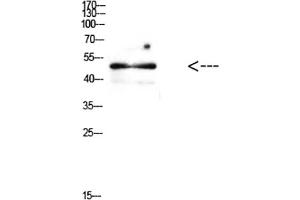 Western Blot analysis of mouse brain cells using Antibody diluted at 1:500. (E2F1 抗体  (AA 100-170))