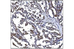 IHC analysis of Serum Response Factor/SRF using anti-Serum Response Factor/SRF antibody (ABIN7600213).
