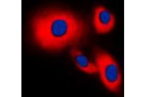 Immunofluorescent analysis of CDC25B staining in THP1 cells. (CDC25B 抗体  (Center))