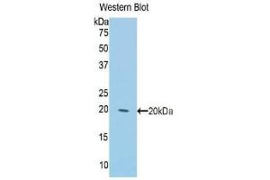 Western blot analysis of the recombinant protein. (Keratin 2 抗体  (AA 368-507))