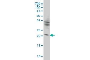 KIF26A monoclonal antibody (M01), clone 3C10 Western Blot analysis of KIF26A expression in HeLa . (KIF26A 抗体  (AA 1-203))
