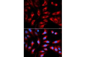 Immunofluorescence (IF) image for anti-Dynamin 1-Like (DNM1L) (AA 411-710) antibody (ABIN3023670)