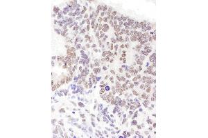Immunohistochemistry (IHC) image for anti-serine/arginine-Rich Splicing Factor 6 (SRSF6) (AA 250-300) antibody (ABIN7454941) (SFRS6 抗体  (AA 250-300))