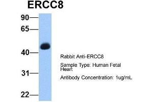 Host:  Rabbit  Target Name:  ERCC8  Sample Type:  Human Fetal Heart  Antibody Dilution:  1. (ERCC8 抗体  (C-Term))