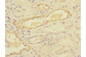 Immunohistochemistry of paraffin-embedded human kidney tissue using ABIN7159906 at dilution of 1:100 (TIMM5 (AA 87-353) 抗体)
