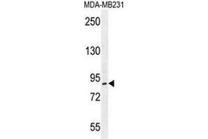 PCAF Antibody (N-term) western blot analysis in MDA-MB231 cell line lysates (35µg/lane). (KAT2B 抗体  (N-Term))