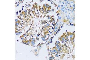 Immunohistochemistry of paraffin-embedded mouse testis using C antibody (ABIN6129635, ABIN6137807, ABIN6137808 and ABIN6217796) at dilution of 1:100 (40x lens).