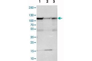 Western blot analysis of cell lysates with SMEK1 polyclonal antibody . (SMEK1 抗体)