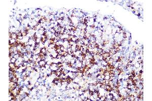 Immunohistochemistry of paraffin-embedded human appendix using LDHB Rabbit mAb (ABIN7268170) at dilution of 1:100 (40x lens). (LDHB 抗体)