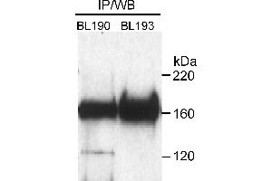 Immunoprecipitation (IP) image for anti-RAD50 Homolog (S. Cerevisiae) (RAD50) (AA 50-100) antibody (ABIN7449576)
