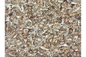 Immunohistochemical staining of paraffin-embedded Human liver tissue using anti-BECN1 mouse monoclonal antibody. (Beclin 1 抗体)