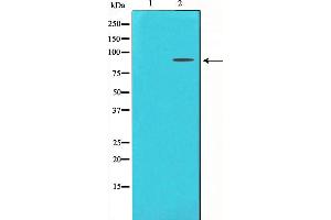 Western blot analysis on LOVO cell lysate using FGFR3 Antibody,The lane on the left is treated with the antigen-specific peptide. (FGFR3 抗体  (C-Term))