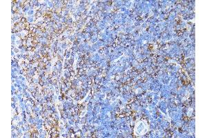 Immunohistochemistry (Paraffin-embedded Sections) (IHC (p)) image for anti-Actin, beta (ACTB) antibody (ABIN3020544)